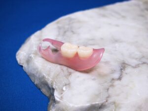 ノンクラスプデンチャー